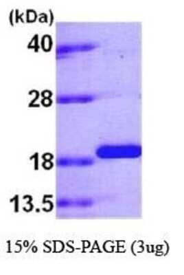 SDS-PAGE: Recombinant Human PPIL1 His Protein [NBC1-18379]