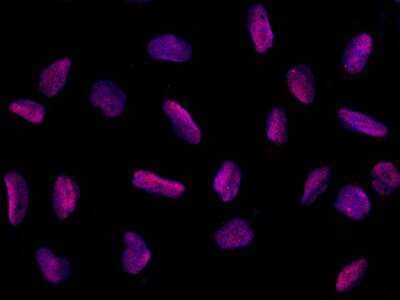 Immunocytochemistry/ Immunofluorescence: PPIL2 Antibody (015) [NBP2-90282]