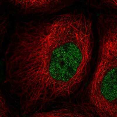 Immunocytochemistry/ Immunofluorescence: PPIL2 Antibody [NBP2-55761]