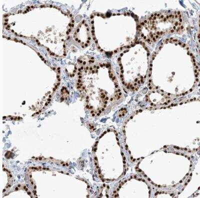 Immunohistochemistry-Paraffin: PPIL2 Antibody [NBP1-85360]