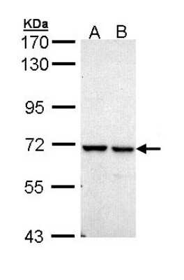 Western Blot: PPIL2 Antibody [NBP1-32933]