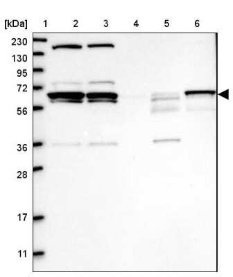 Western Blot: PPIL2 Antibody [NBP1-85360]