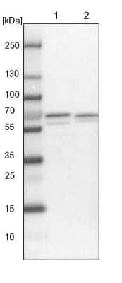 Western Blot: PPIL2 Antibody [NBP1-85360]