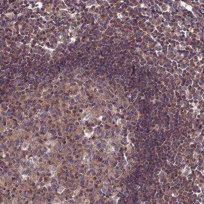 Immunohistochemistry-Paraffin: PPIL3 Antibody [NBP2-13794]