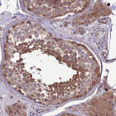 Immunohistochemistry-Paraffin: PPIL3 Antibody [NBP2-13794]