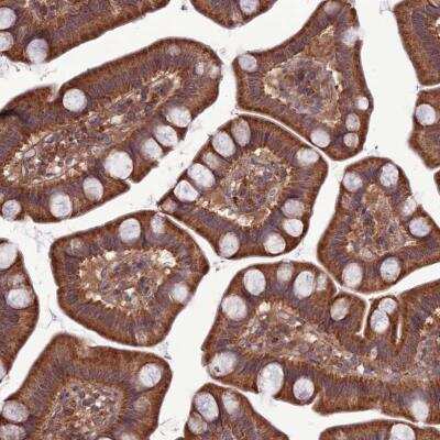 Immunohistochemistry-Paraffin: PPIL3 Antibody [NBP2-13794]
