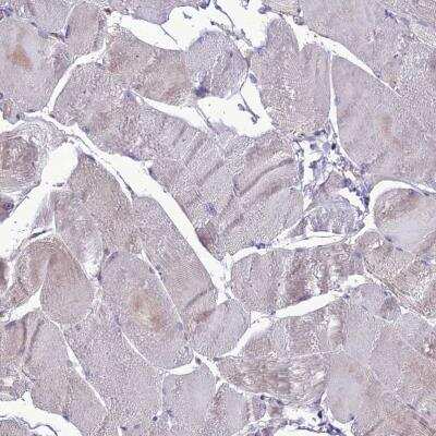 Immunohistochemistry-Paraffin: PPIL3 Antibody [NBP2-13794]