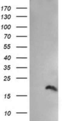 Western Blot: PPIL3 Antibody (OTI2E7)Azide and BSA Free [NBP2-73574]