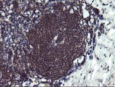 Immunohistochemistry: PPIL3 Antibody (OTI2E7) [NBP2-45901]
