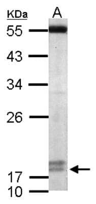 Western Blot: PPIL3 Antibody [NBP2-19900]