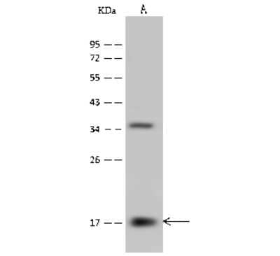 Western Blot: PPIL3 Antibody [NBP2-99600]