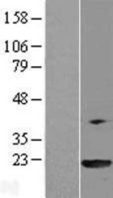 Western Blot: PPIL3 Overexpression Lysate [NBL1-14653]