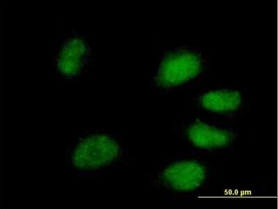 Immunocytochemistry/ Immunofluorescence: PPIL4 Antibody [H00085313-B01P]