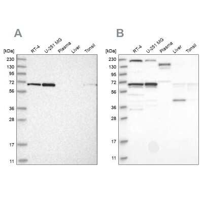 Western Blot: PPIL4 Antibody [NBP1-85921]