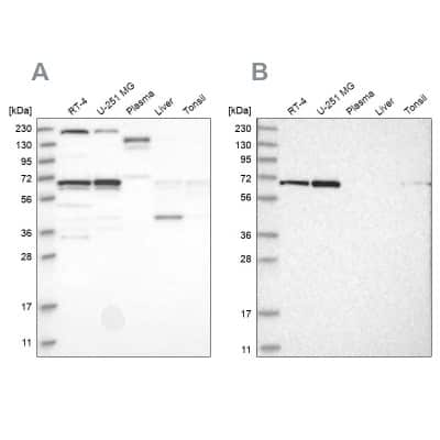 Western Blot: PPIL4 Antibody [NBP2-55080]