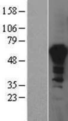 Western Blot: PPIL4 Overexpression Lysate [NBP2-04420]