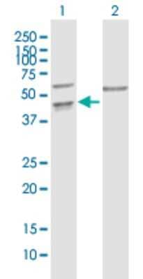 Western Blot: PPIL5 Antibody [H00122769-B02P]