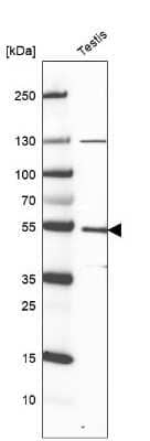 Western Blot: PPIL5 Antibody [NBP2-57485]