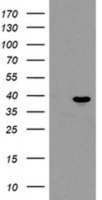 Western Blot: PPIL6 Antibody (OTI4F2) [NBP2-03728]