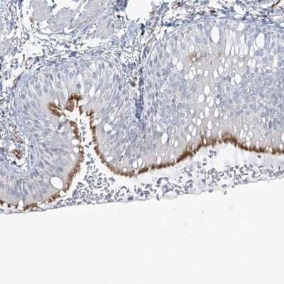 Immunohistochemistry-Paraffin: PPIL6 Antibody [NBP1-88766]
