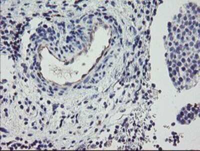 Immunohistochemistry: PPIL6 Antibody (OTI4F2) - Azide and BSA Free [NBP2-73578]