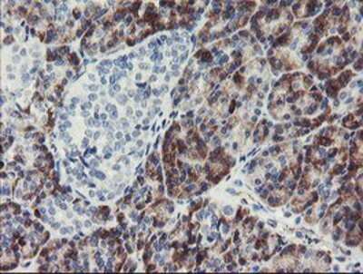 Immunohistochemistry: PPIL6 Antibody (OTI4F2) - Azide and BSA Free [NBP2-73578]