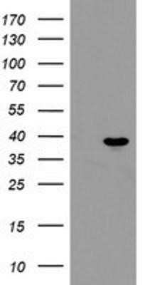 Western Blot: PPIL6 Antibody (OTI4F2)Azide and BSA Free [NBP2-73578]