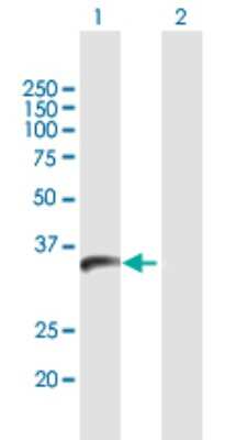 Western Blot: PPIL6 Antibody [H00285755-B01P]