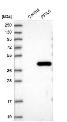 Western Blot: PPIL6 Antibody [NBP1-88766]