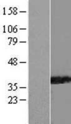 Western Blot: PPIL6 Overexpression Lysate [NBL1-14655]