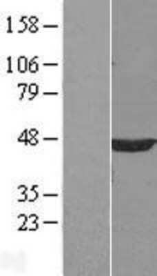 Western Blot: PP2C alpha/PPM1A Overexpression Lysate [NBL1-14656]