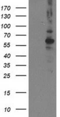 Western Blot: PP2C beta/PPM1B Antibody (OTI3F2) [NBP2-00720]