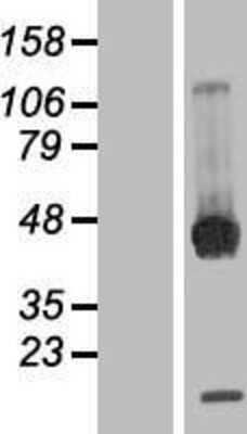 Western Blot: PP2C beta/PPM1B Overexpression Lysate [NBP2-05005]