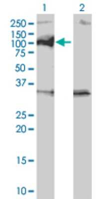 Western Blot: PPM1D Antibody (4D1) [H00008493-M01]