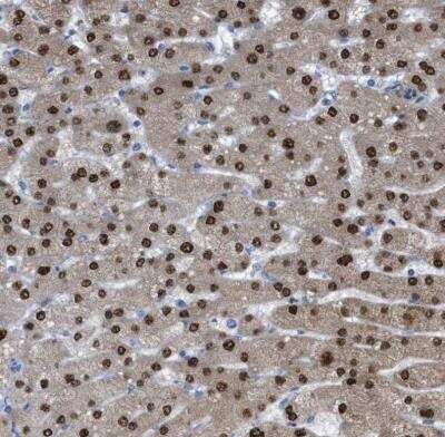Immunohistochemistry-Paraffin: PPM1D Antibody [NBP1-87249]