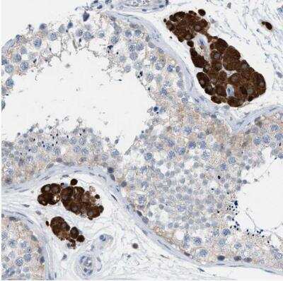 Immunohistochemistry-Paraffin: PPM1D Antibody [NBP1-87249]