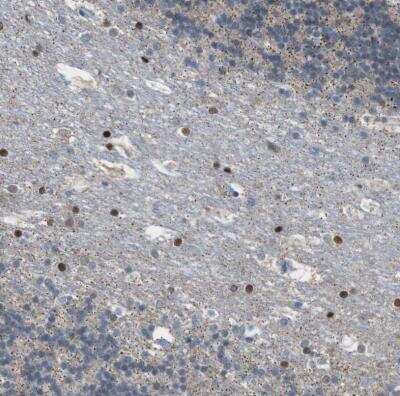 Immunohistochemistry-Paraffin: PPM1D Antibody [NBP1-87249]