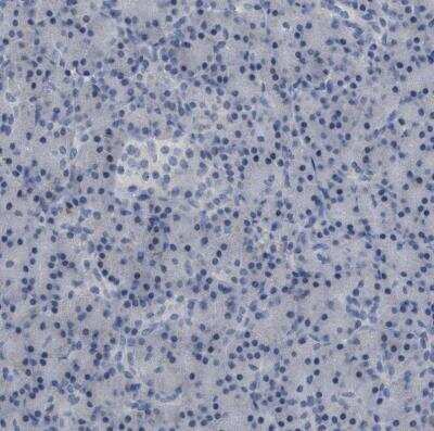 Immunohistochemistry-Paraffin: PPM1D Antibody [NBP1-87249]