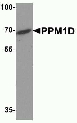 Western Blot: PPM1D AntibodyBSA Free [NBP2-81881]