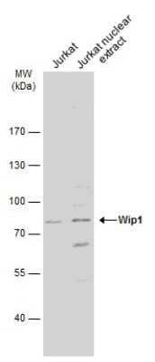 Western Blot: PPM1D Antibody [NBP3-12941]