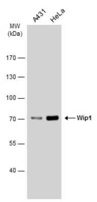 Western Blot: PPM1D Antibody [NBP3-12941]