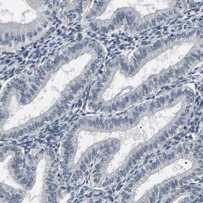 Immunohistochemistry-Paraffin: PPM1E Antibody [NBP1-86649]