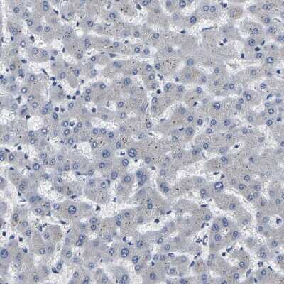 Immunohistochemistry-Paraffin: PPM1E Antibody [NBP1-86649]
