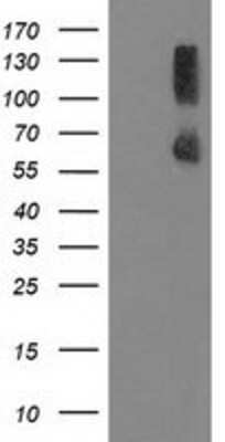 Western Blot: PP2C gamma/PPM1G Antibody (OTI1C12) [NBP2-03463]
