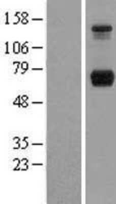 Western Blot: PP2C gamma/PPM1G Overexpression Lysate [NBL1-14663]