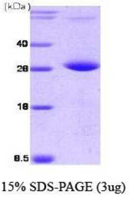 SDS-PAGE: Recombinant Human PP2C gamma/PPM1G His Protein [NBC1-18399]