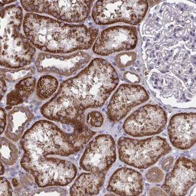 Immunohistochemistry: PPM1H Antibody [NBP2-38859]