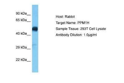 Western Blot: PPM1H Antibody [NBP2-88082]