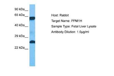 Western Blot: PPM1H Antibody [NBP2-88083]