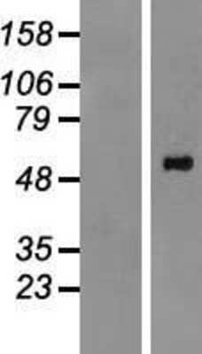 Western Blot: PPM1H Overexpression Lysate [NBP2-06626]